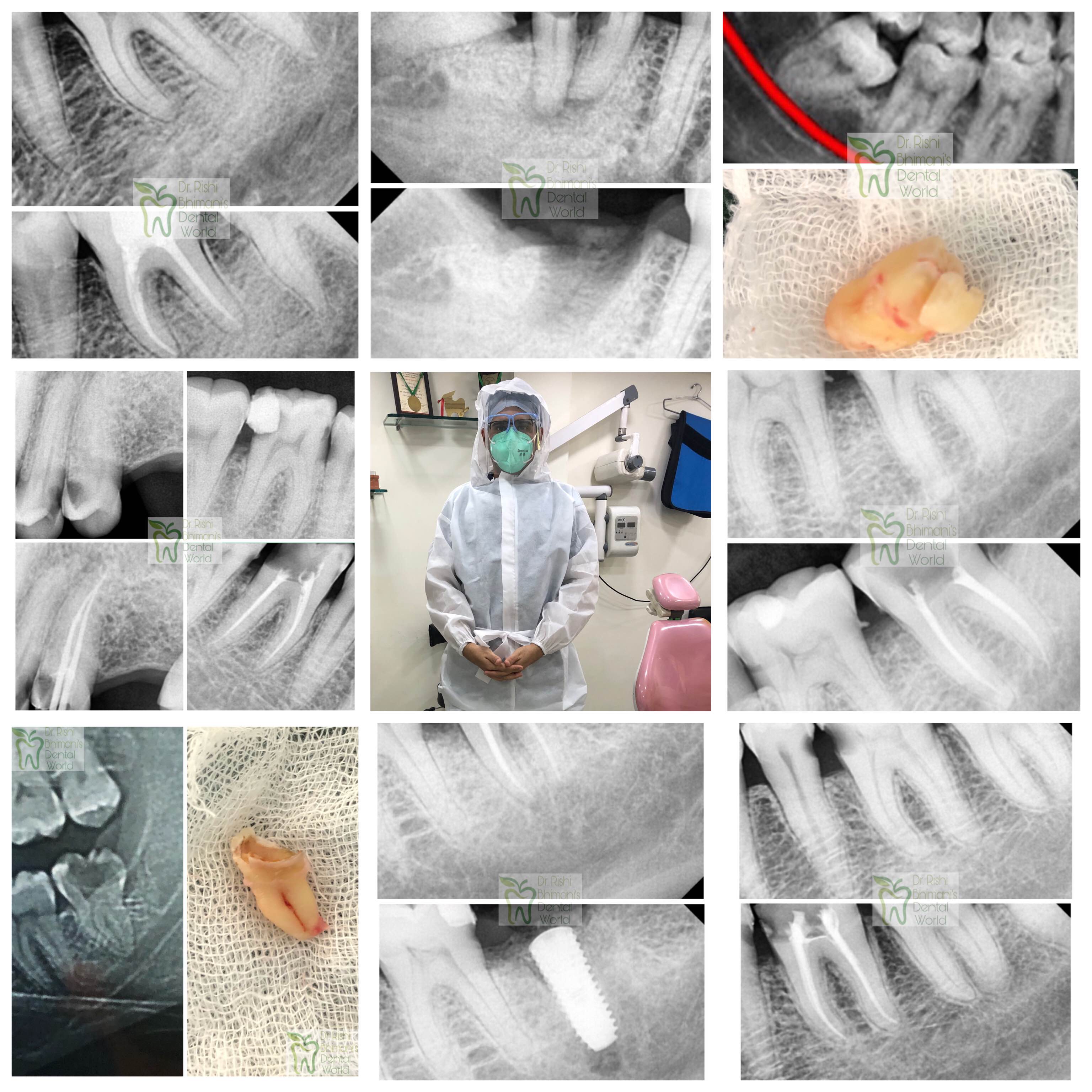 At Dr. Rishi’s Dental Clinic, Vashi, Navi Mumba... main image