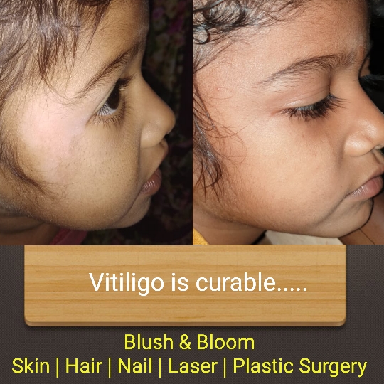 Think_Skin_Think_Blush_& _Bloom skin_specialist_in... main image