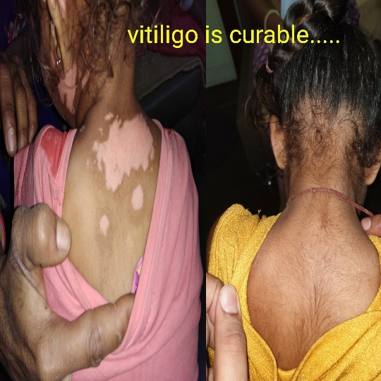 Think_Skin_Think_Blush_& _Bloom skin_specialist_in... main image