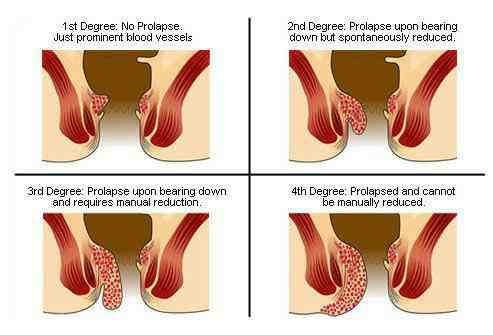 Dr. Phapale Hospital, Otur
Centre for Piles & G... main image