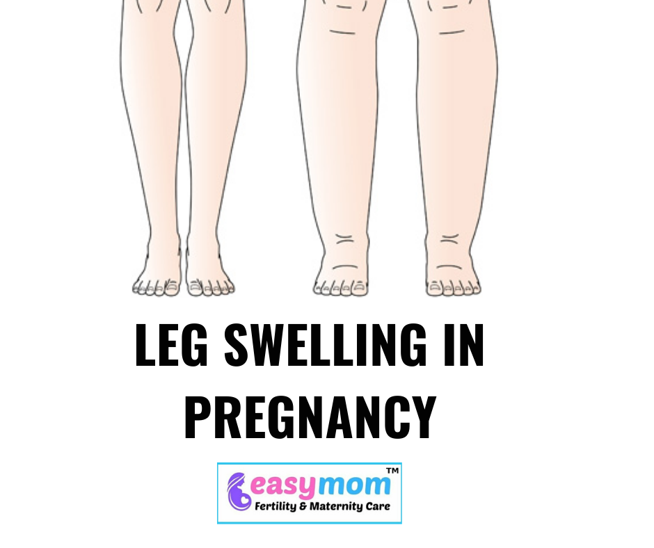 Swelling Leg During Pregnancy Pin On Growing Humans Such stockings