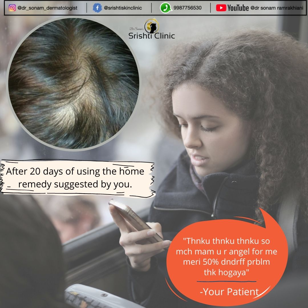 protini polypeptide cream acne