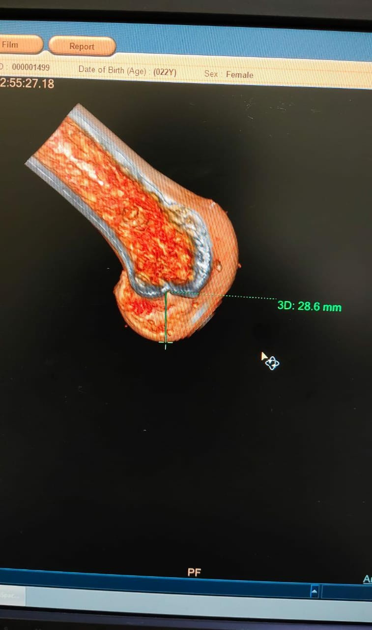 Orthopedic surgeon with special interest in adv... main image