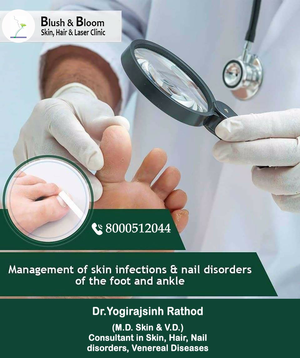 Nail care is as important as hair as nails are ... main image