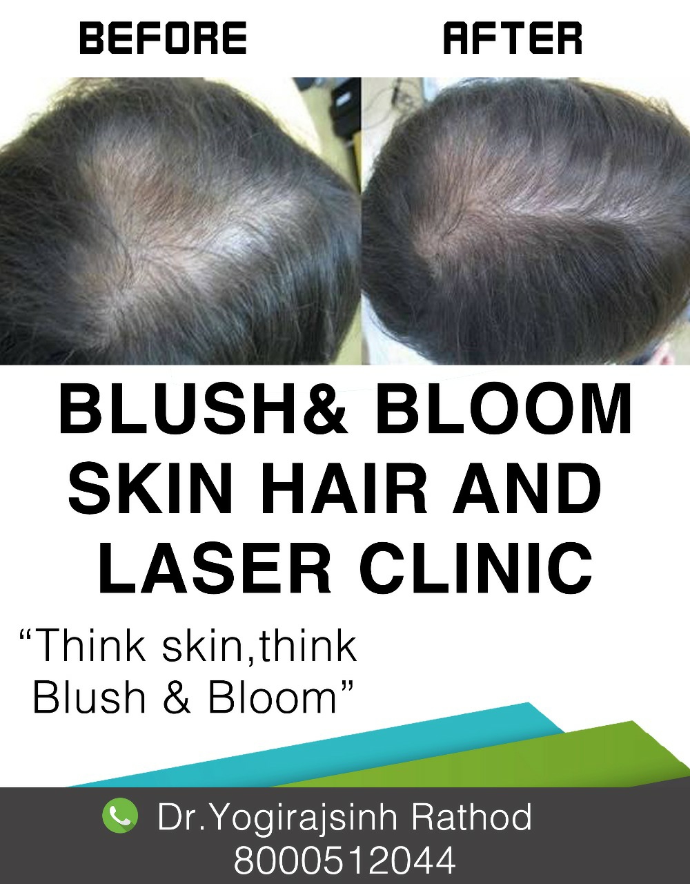Because hair is the crown in your head, don't let ... main image