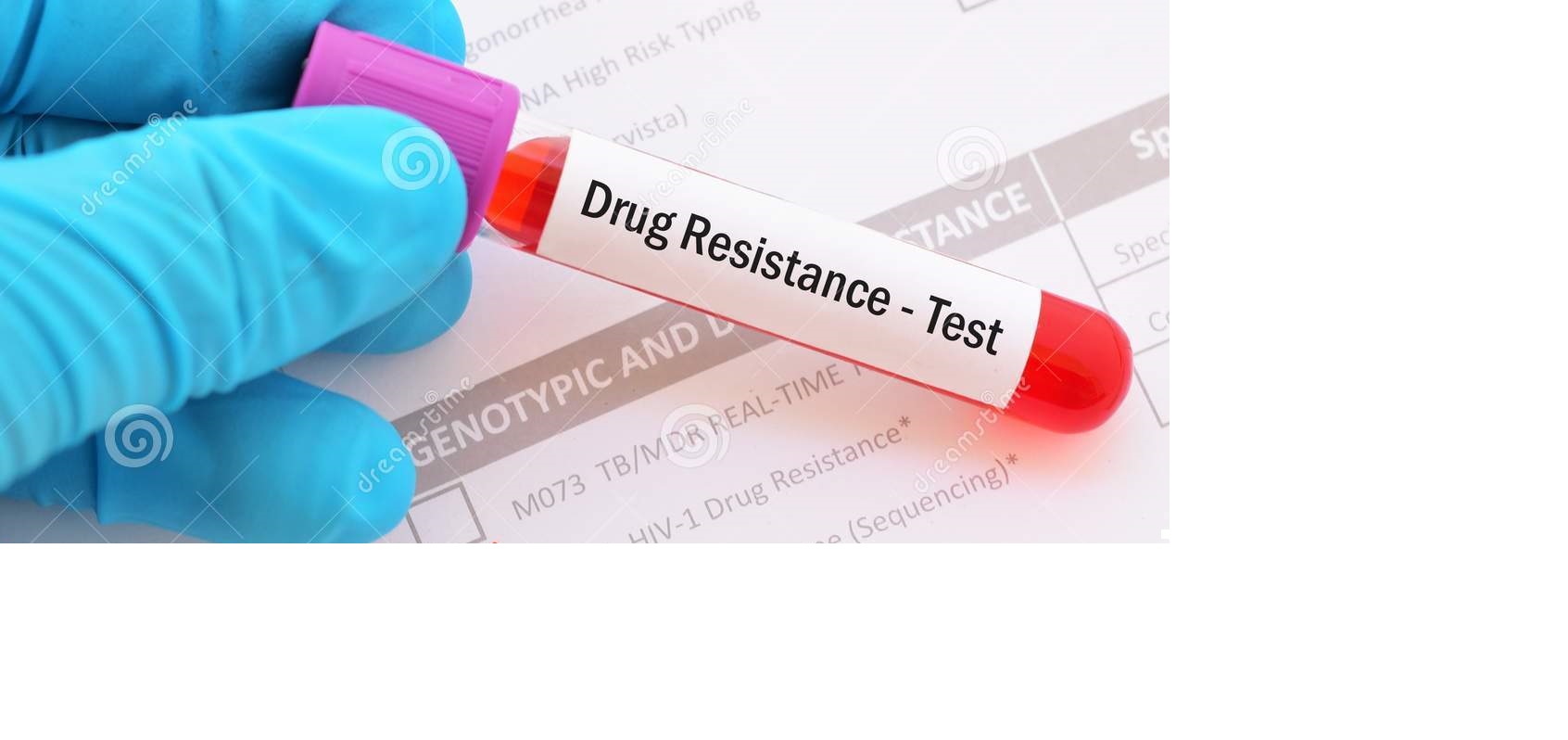 HIV DRUG RESISTANCE TEST
Is done in patients wh... main image