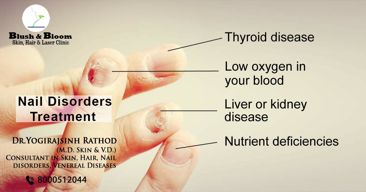 Think_Skin_Think_Blush_& _Bloom skin_specialist_in... main image