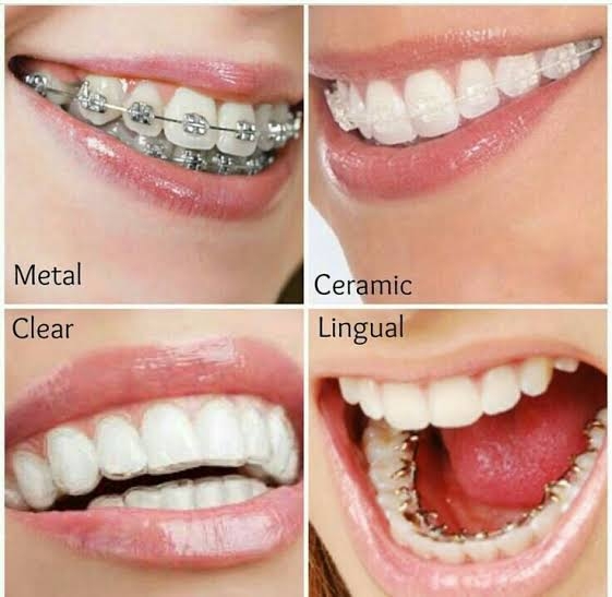 Not everyone is born with beautiful smile. Crooked... main image