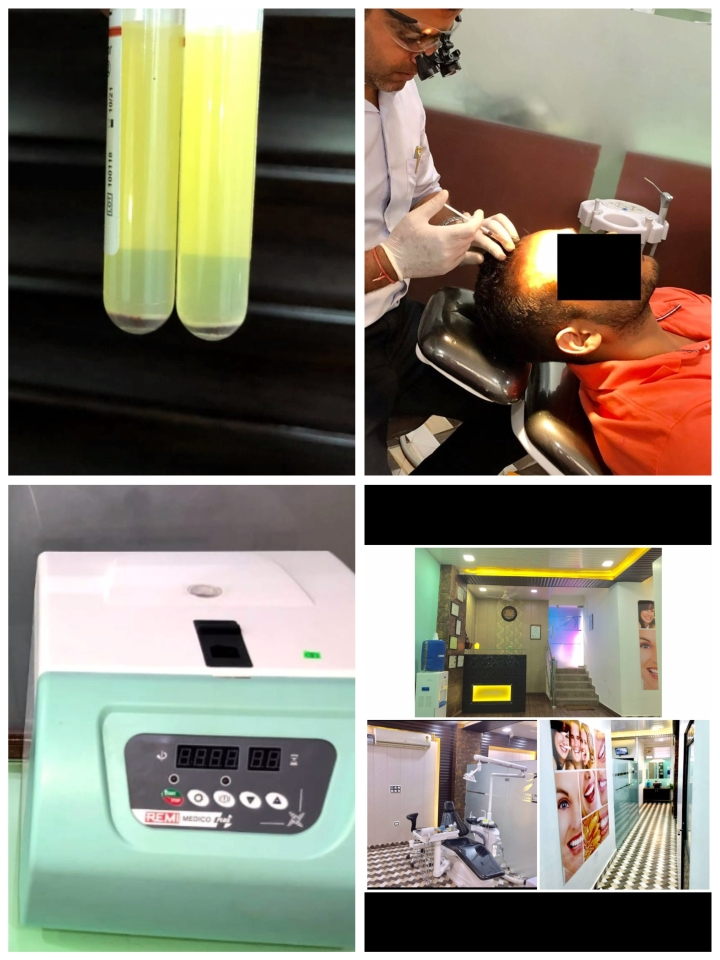 PRP (platelet rich plasma) is simple safe and effe... main image