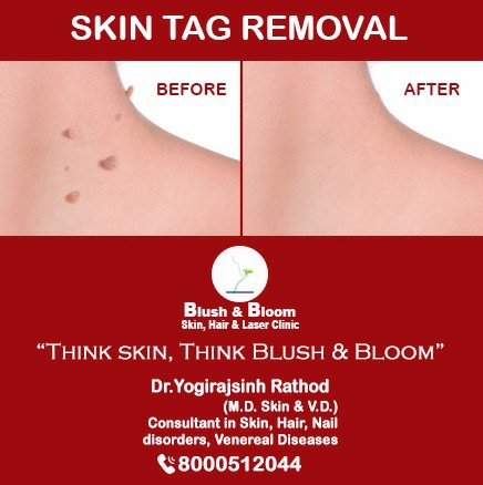 Think_Skin_Think_Blush_& _Bloom skin_specialist_in... main image
