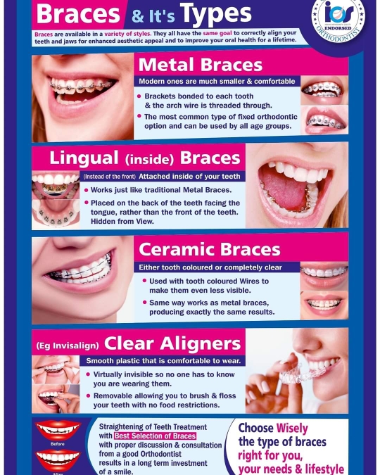 Braces are the magical tool that help to correc... main image