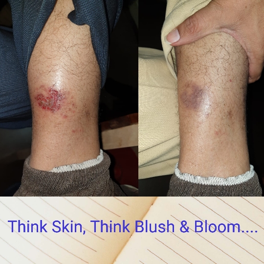 Think_Skin_Think_Blush_& _Bloom skin_specialist_in... main image