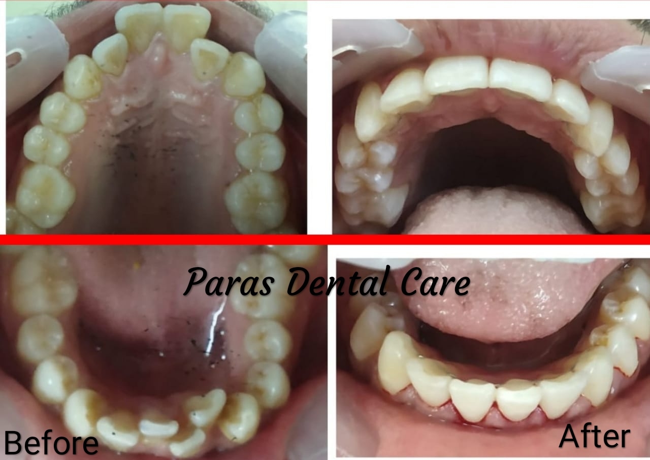 Smile is an important part of personality. It boos... main image