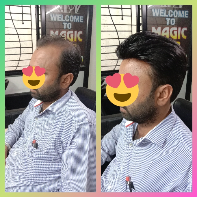 Hair Weaving and Wig center Nagpur 8806885016 Magic Hair Weaving Centre