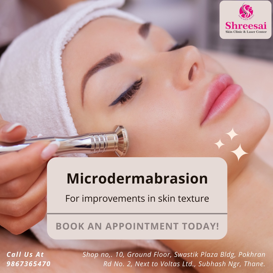 Microdermabrasion is the best treatment for you... main image