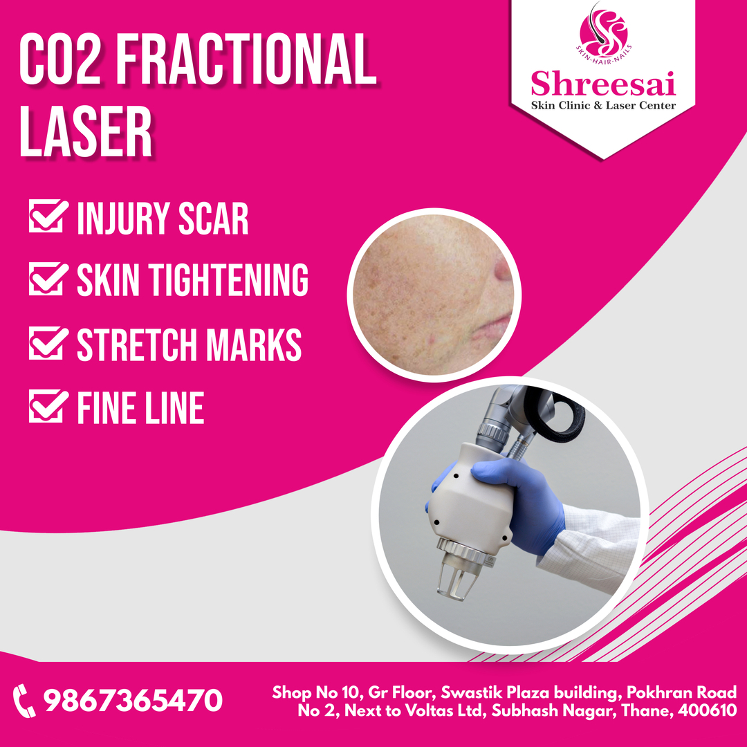 A fractional CO2 laser is a type of skin treatm... main image