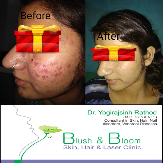 Think_Skin_Think_Blush_& _Bloom skin_specialist_in... main image