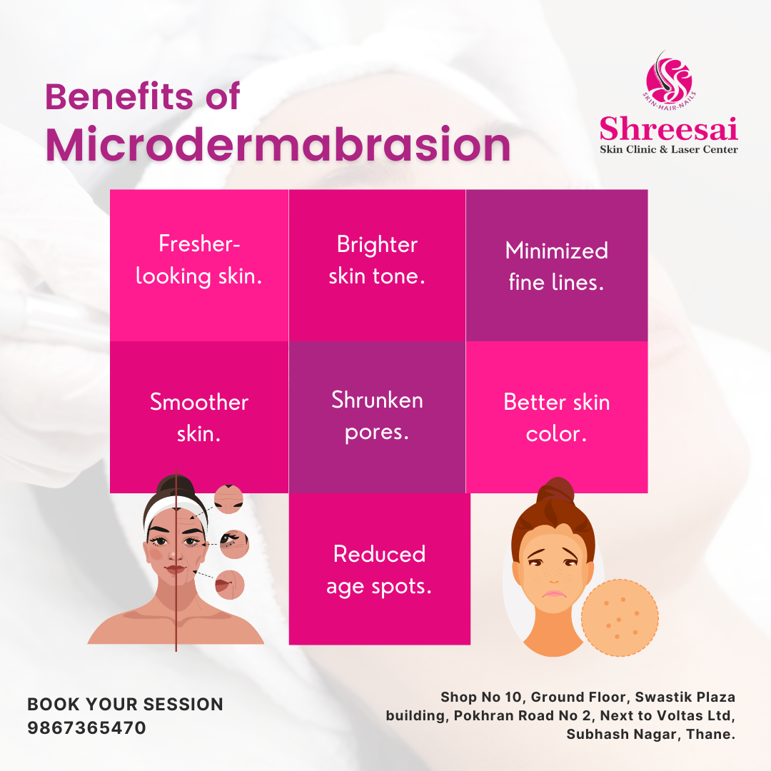 These are the Benefits of Microdermabrasion. So... main image