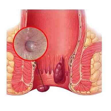 Dr.Phapale Hospital, Otur
Piles Clinic, Manchar... main image