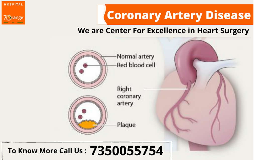 7 ORANGE IS BEST HOSPITAL IN PCMC FOR HEART SUR... main image