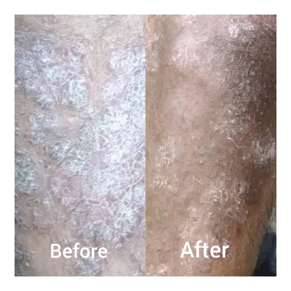 update image