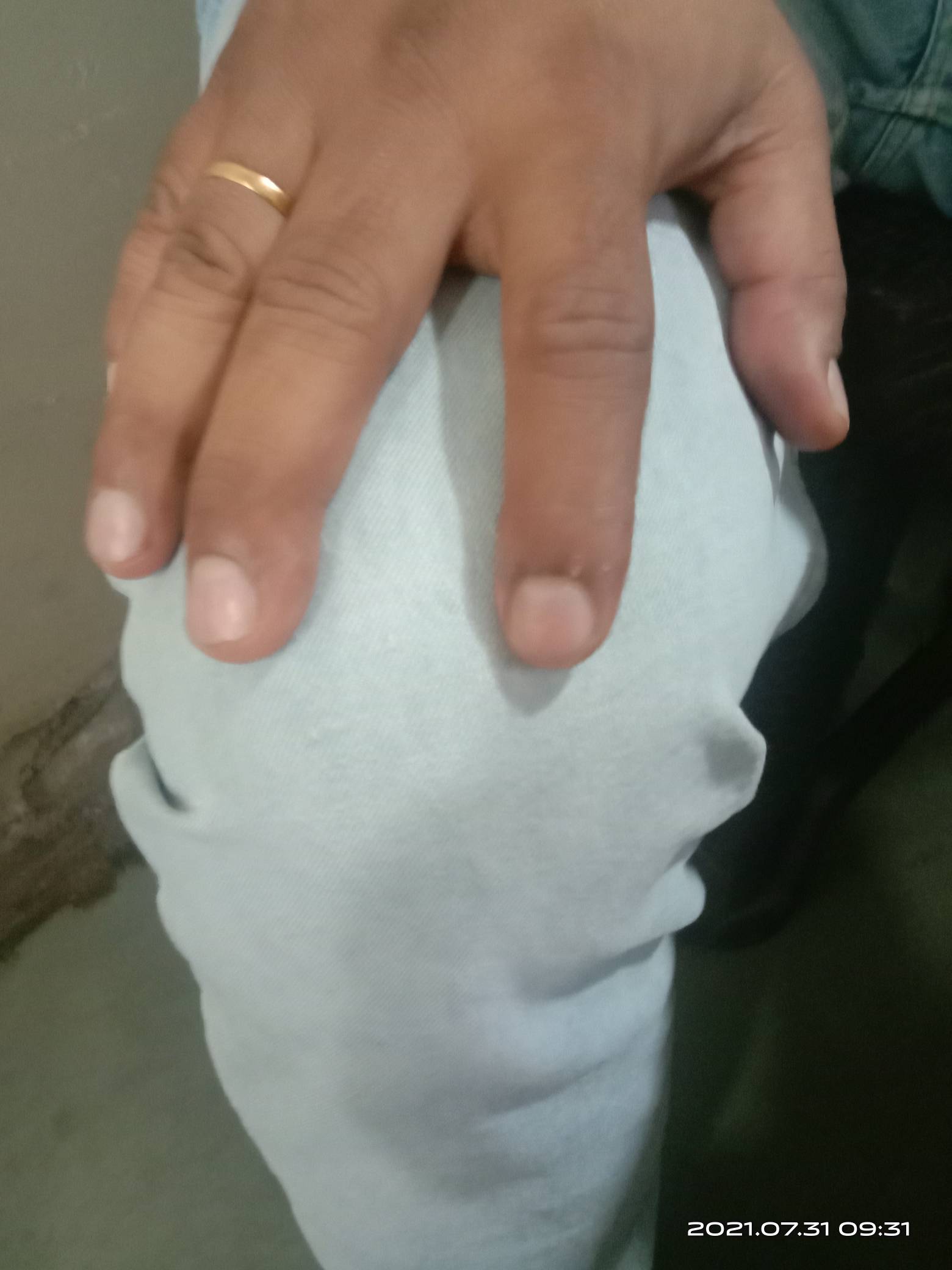 update image