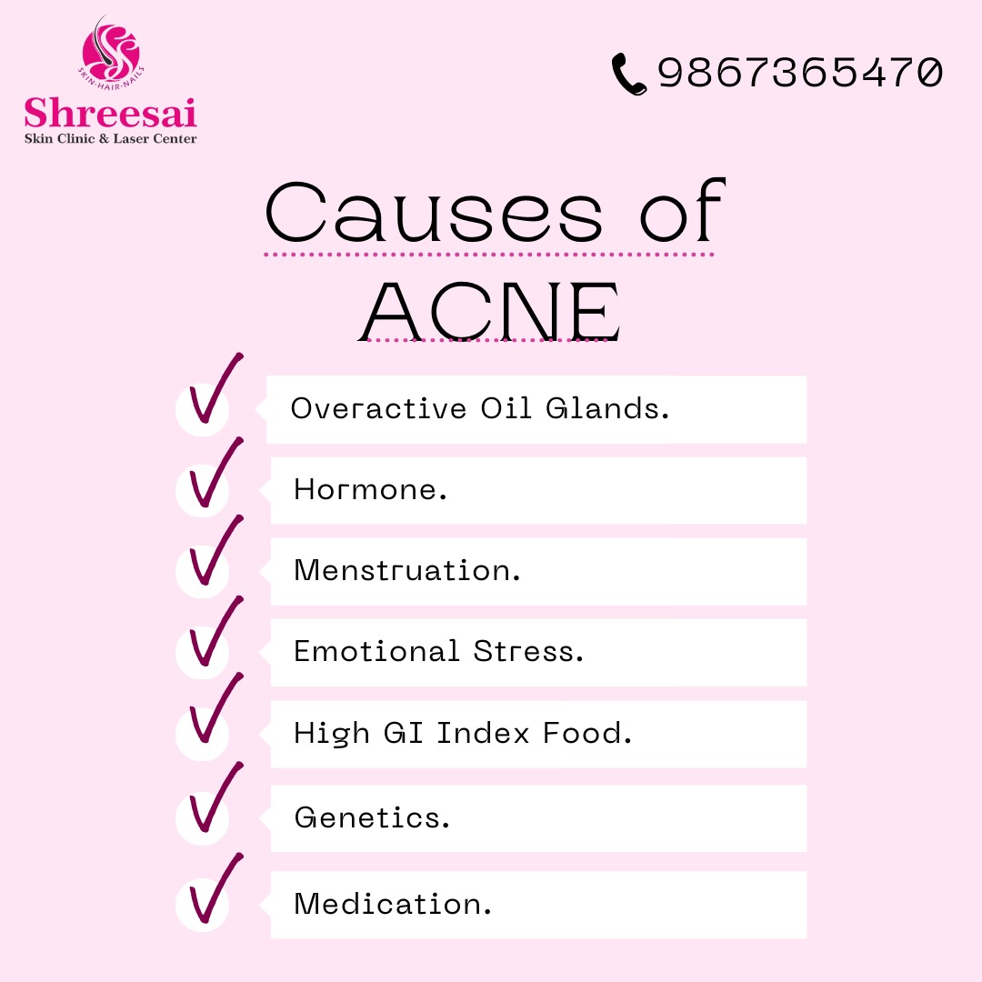 Acne is a skin condition that can occur at any ... main image