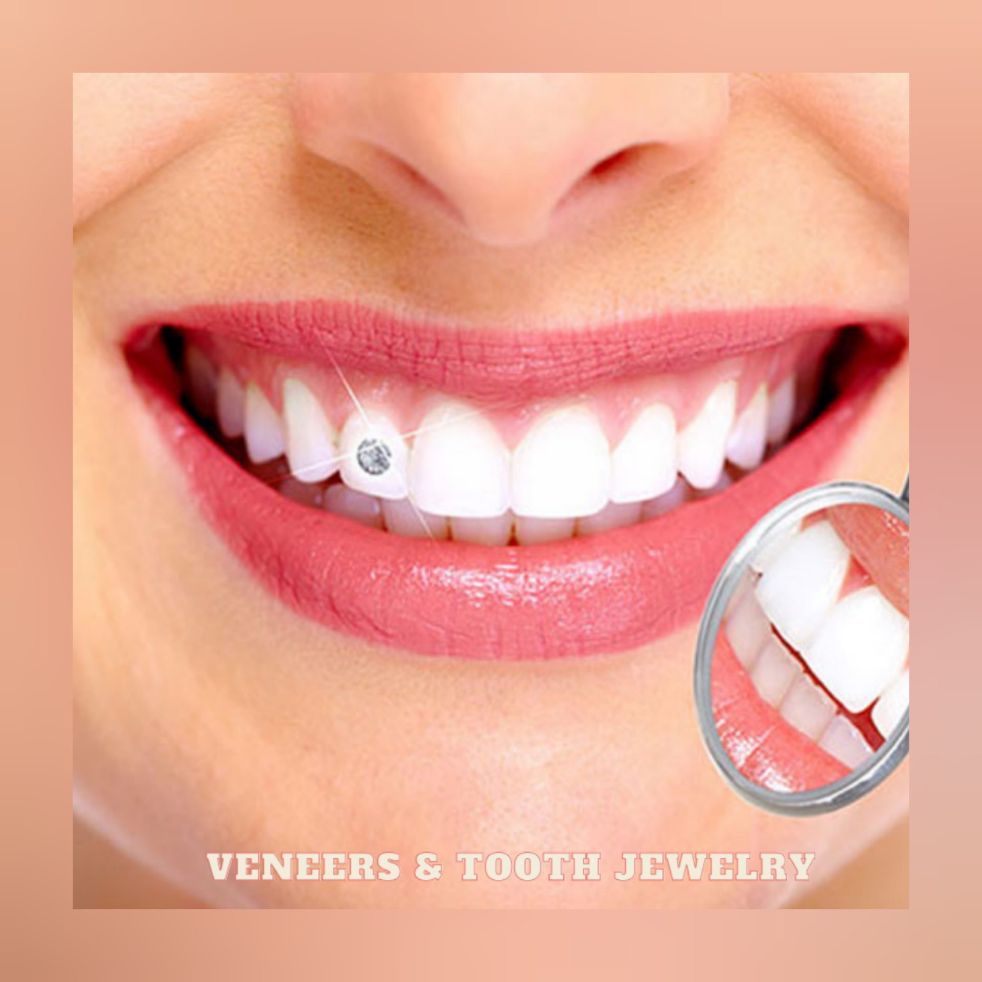 ARE YOU LOOKING VENEERS & TOOTH JEWELRY CLINIC ... main image