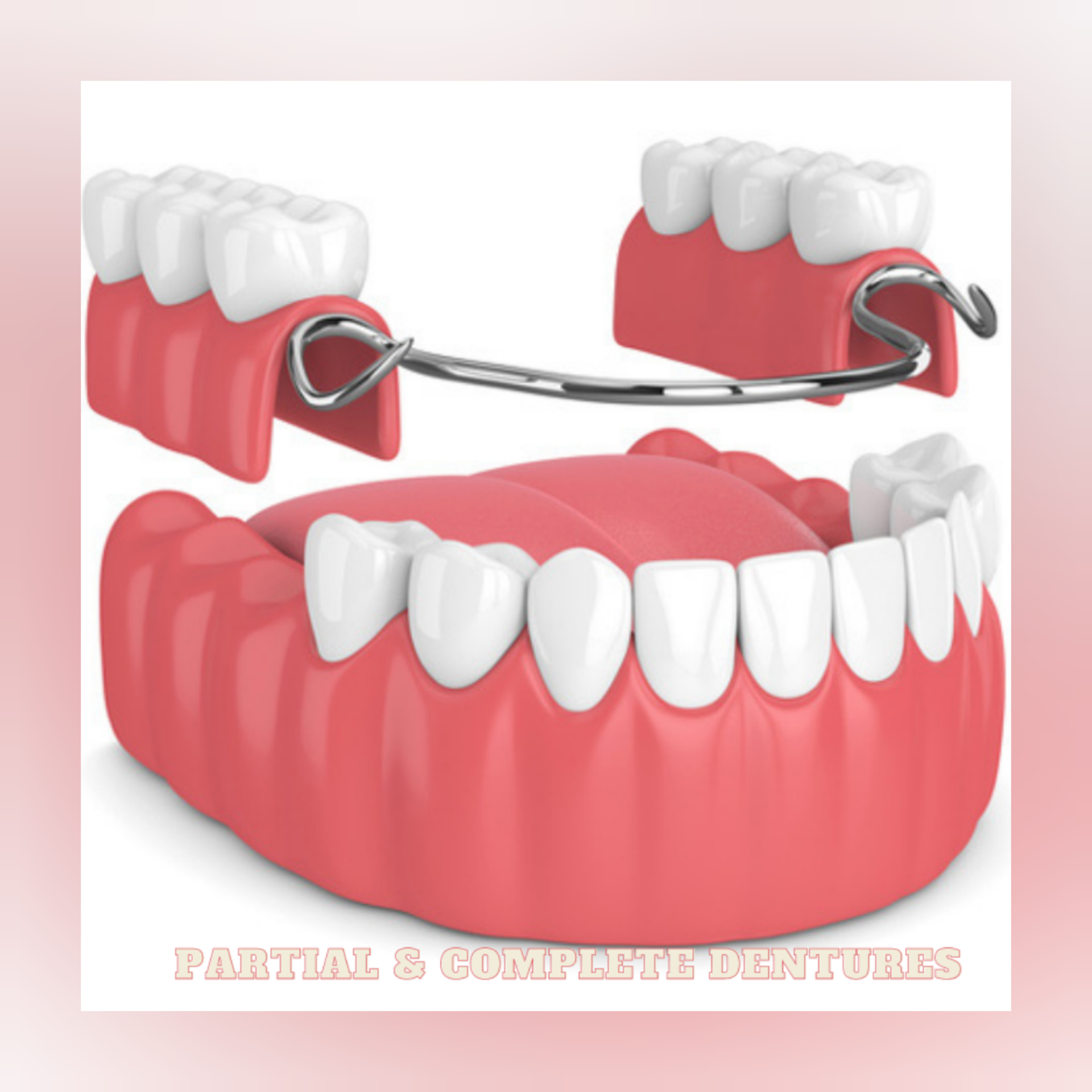 SEARCHING PARTIAL & COMPLETE DENTURES CLINIC IN... main image