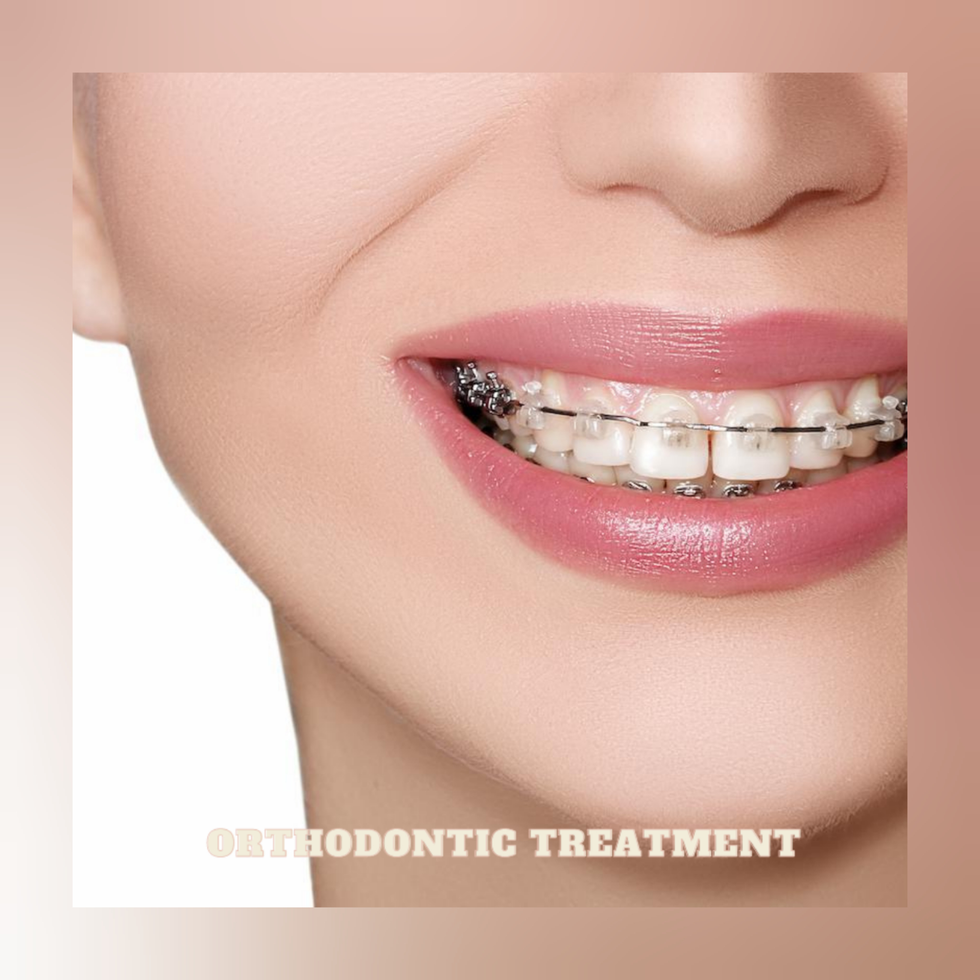 FINDING ORTHODONTIC TREATMENT CLINIC IN WAKAD, ... main image