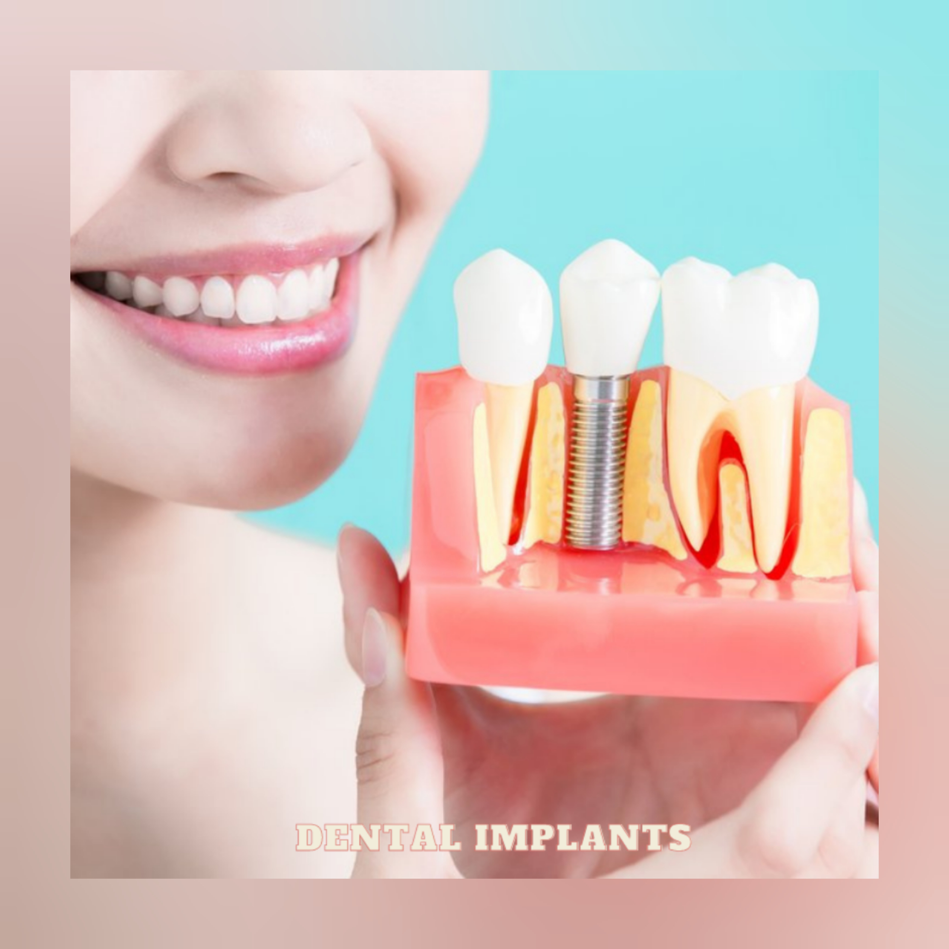 DO YOU WANT TO VISIT DENTAL IMPLANT CLINIC IN W... main image