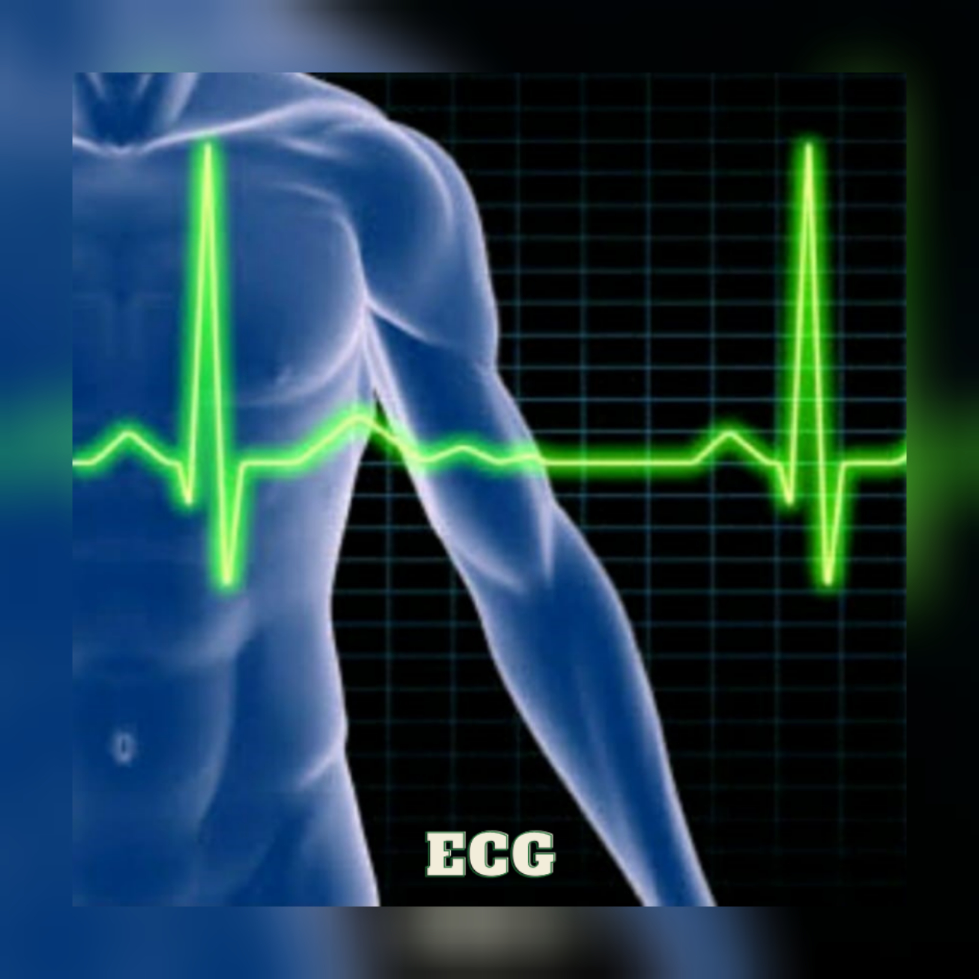 Searching ECG Test Clinic in Wakad, Hinjewadi, PCM... main image