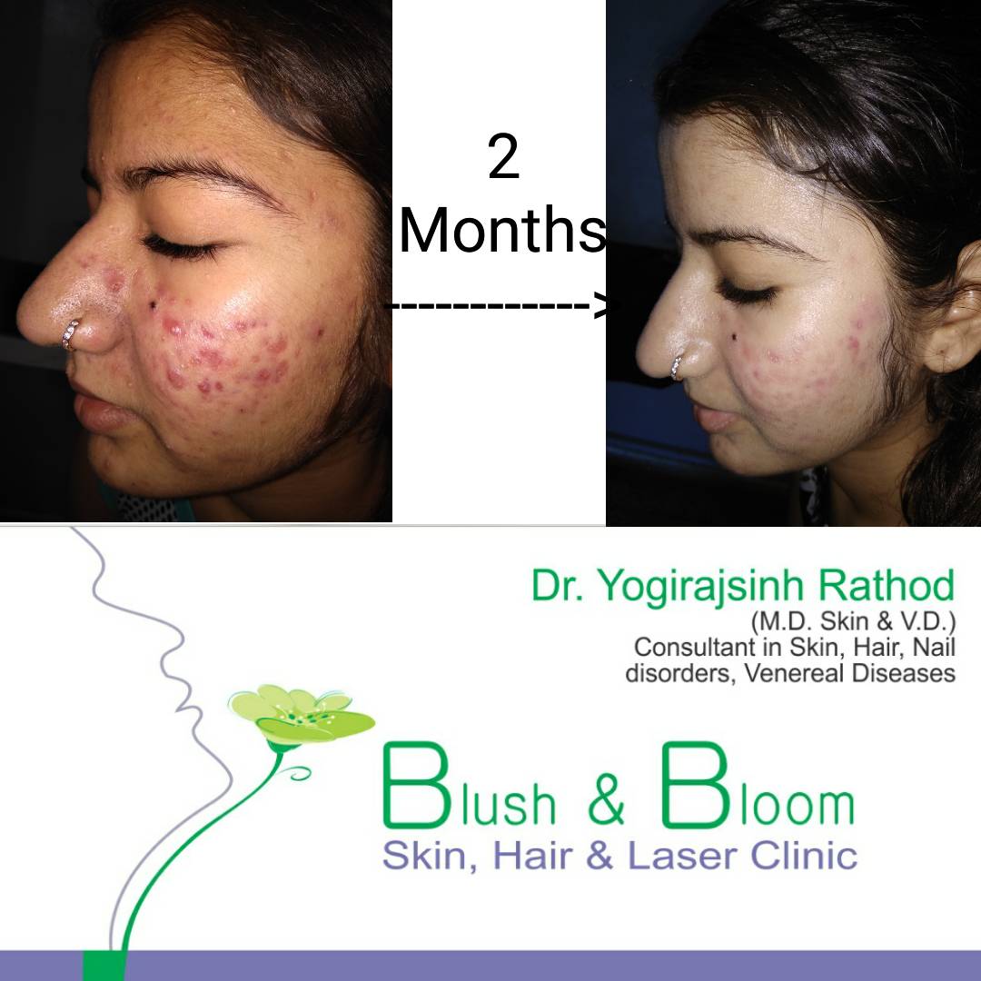 Think_Skin_Think_Blush_& _Bloom skin_specialist_in... main image