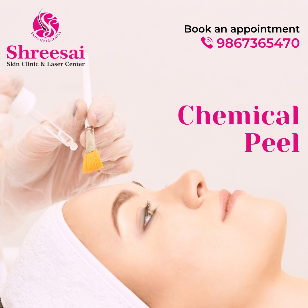 Chemical peels are a popular nonsurgical cosmet... main image