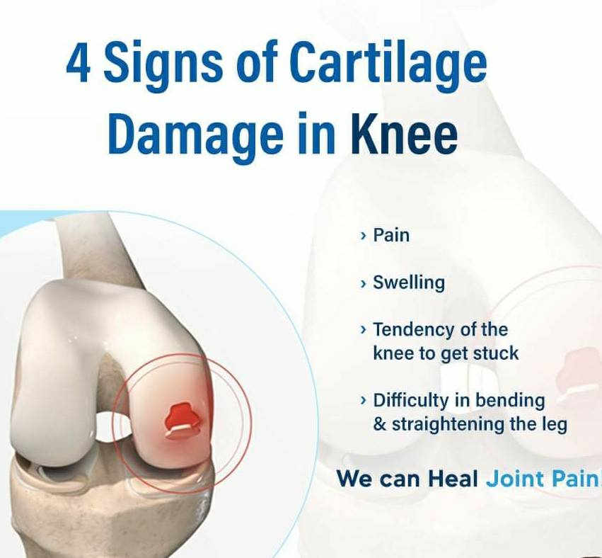 Cartilage injury in young active individual is ... main image