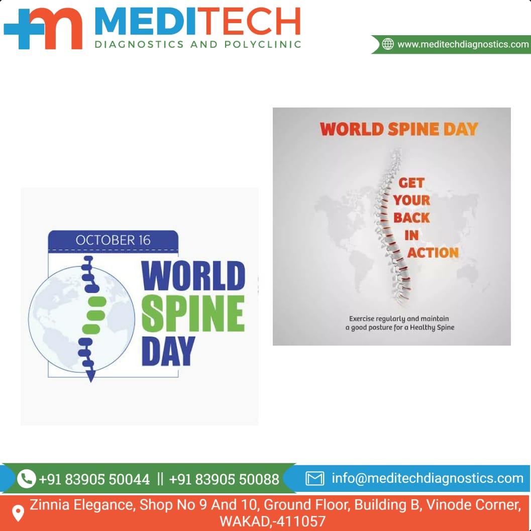World Spine Day ! Get your back in Action.. main image
