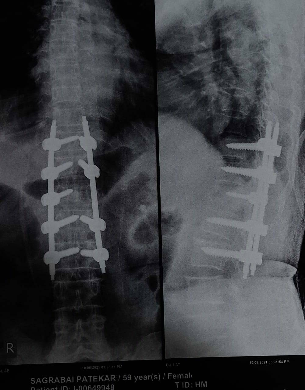 World spine day!
Don't suffer back pain
Avail 5... main image