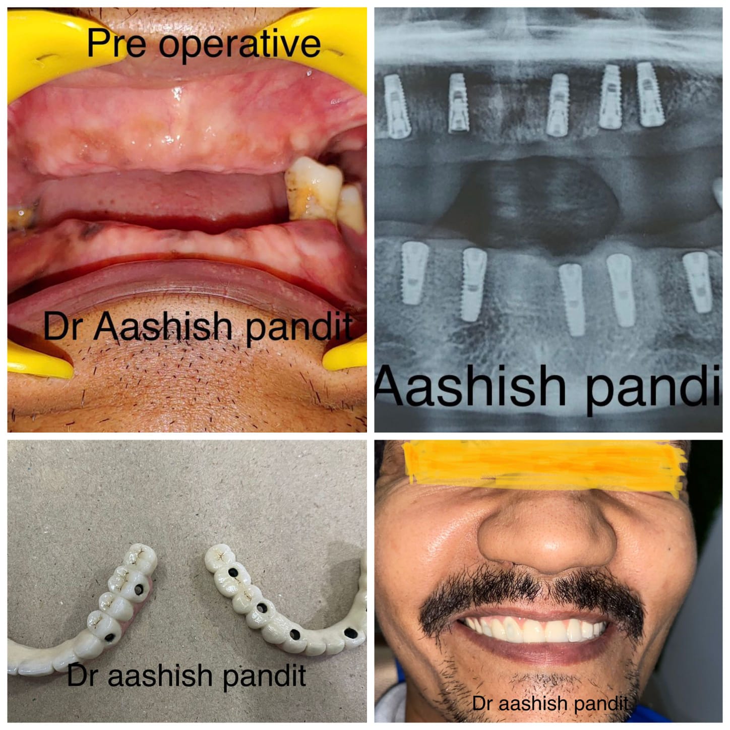 Our teeth not only gives us beautiful smile but al... main image