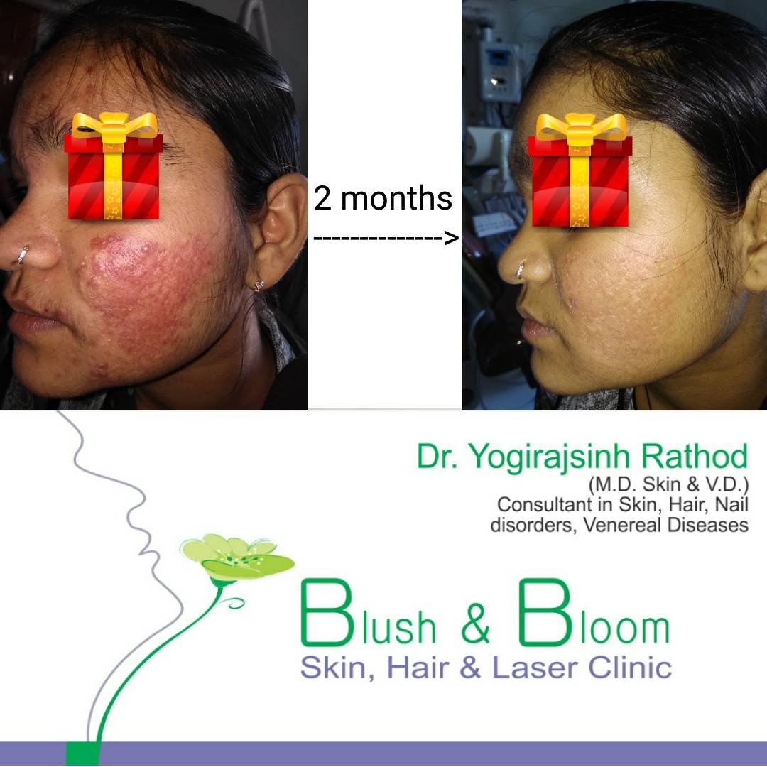 Think_Skin_Think_Blush_& _Bloom skin_specialist_in... main image