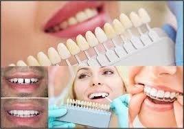 If you want any of the following esthetic denta... main image