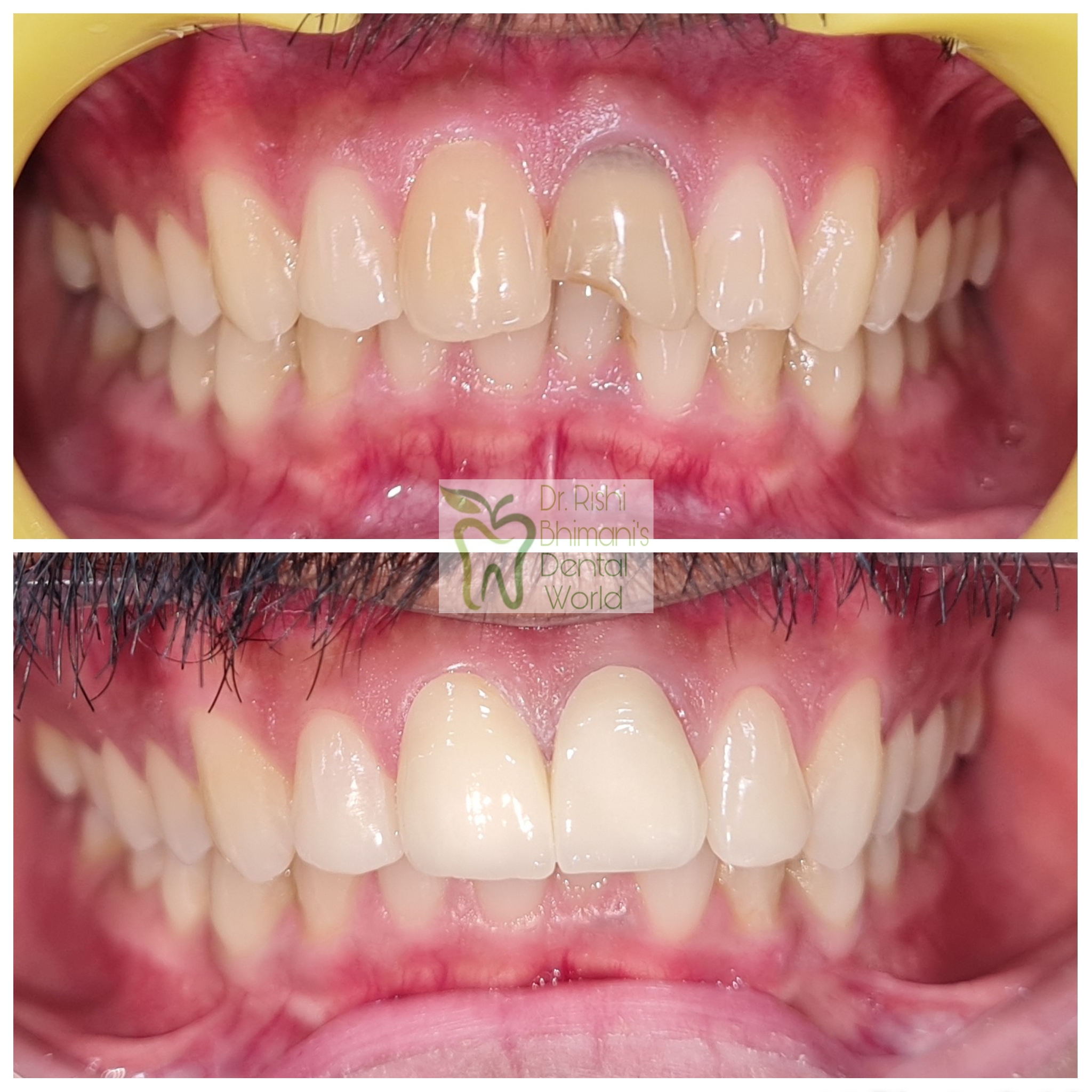 FACIAL TRAUMA or ACCIDENTS at a young age can d... main image