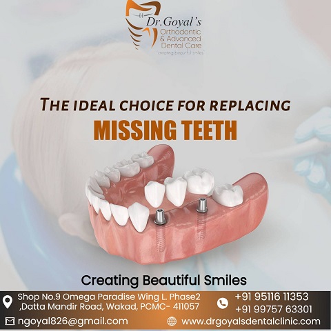Do you want to know more about missing teeth?

... main image