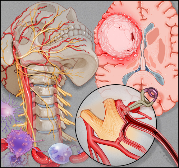 Do you need Neurosurgery Hospital in Wakad/Hinj... main image