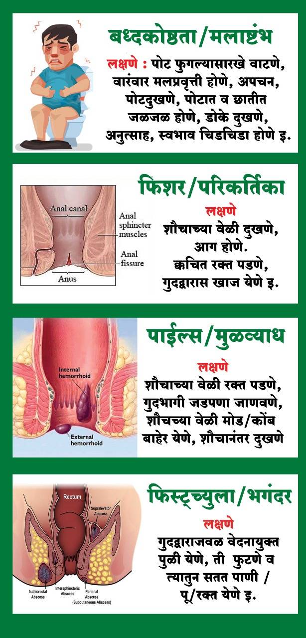 Risk factors in piles:-

Lack of erect posture
... main image