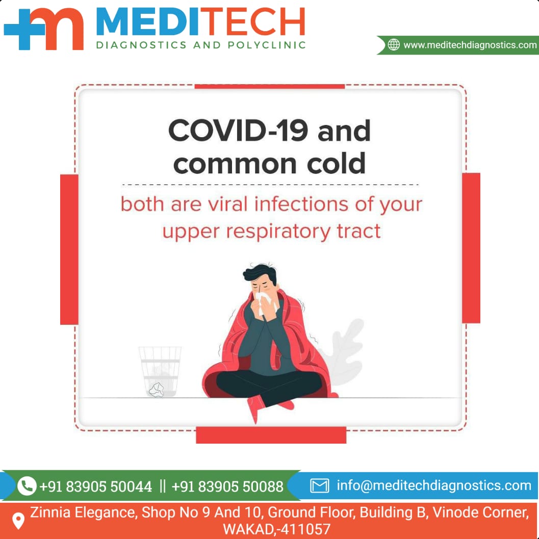 Are you having covid, cough, cold, fever and yo... main image
