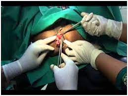 Piles Hospital in Gadchiroli . Piles doctor in ... main image