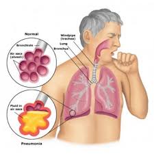 Chest clinic in Nagpur . Best chest physician i... main image
