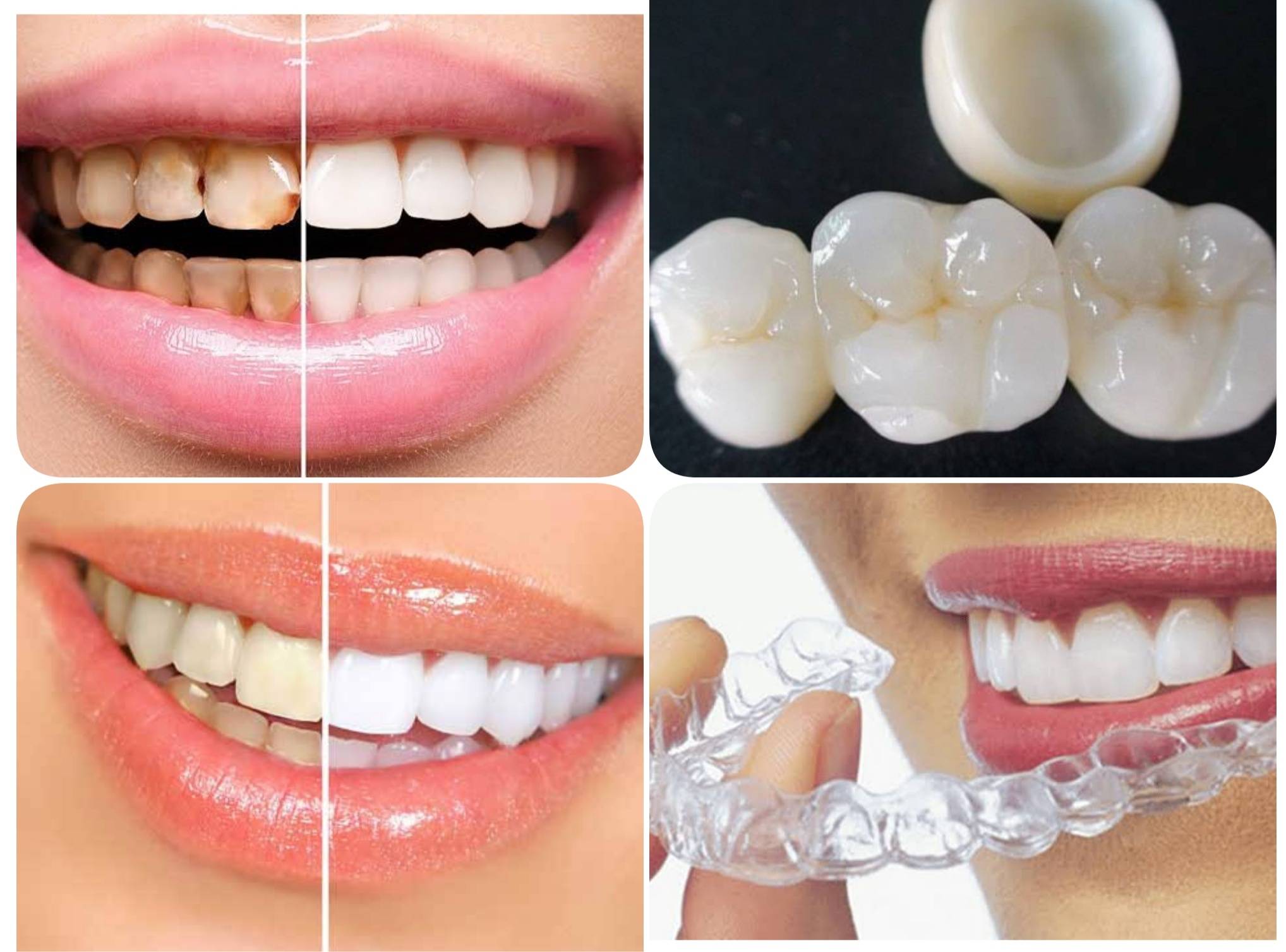 Your smile says a lot about you and it is somet... main image