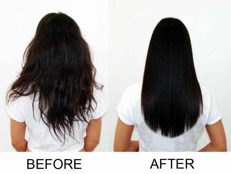 Hairfall after permanent straightening
It is de... main image