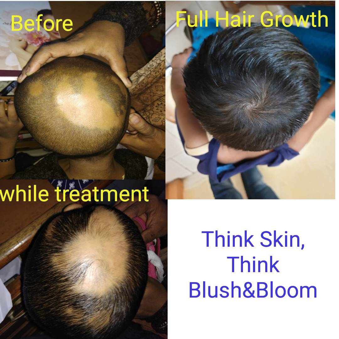 Think_Skin_Think_Blush_& _Bloom skin_specialist_in... main image